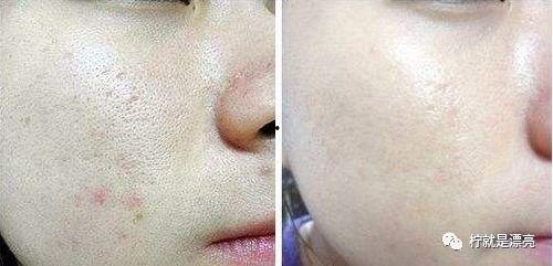 吃鸡皮肤爆料最新车皮肤,吃鸡游戏带你领略速度与激情